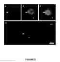 Fig. 06 - Methods and compositions for the packaging of nucleic acids into microglial exosomes for the targeted expression of polypeptides in neural cells