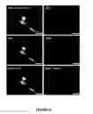 Fig. 09 - Methods and compositions for the packaging of nucleic acids into microglial exosomes for the targeted expression of polypeptides in neural cells