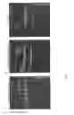 Fig. 14 - Factor VIII chimeric proteins and uses thereof