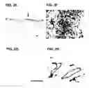 Fig. 06 - SELECTIVE ELIMINATION OF EROSIVE CELLS