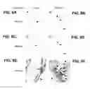 Fig. 24 - SELECTIVE ELIMINATION OF EROSIVE CELLS