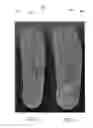 Fig. 03 - FOAMED THERMOPLASTIC POLYURETHANE AND MICROWAVE MOLDED ARTICLE THEREOF
