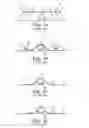 Fig. 02 - CONFORMING SECUREMENT ARTICLES AND METHODS OF USE