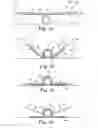 Fig. 04 - CONFORMING SECUREMENT ARTICLES AND METHODS OF USE