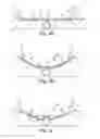 Fig. 06 - CONFORMING SECUREMENT ARTICLES AND METHODS OF USE