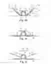 Fig. 07 - CONFORMING SECUREMENT ARTICLES AND METHODS OF USE