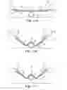 Fig. 10 - CONFORMING SECUREMENT ARTICLES AND METHODS OF USE