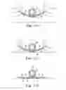 Fig. 11 - CONFORMING SECUREMENT ARTICLES AND METHODS OF USE