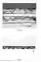 Fig. 04 - Pressure sensitive adhesive tape with microstructured elastomeric core