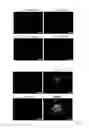 Fig. 04 - Generating hepatocytes