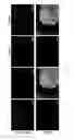Fig. 24 - Generating hepatocytes