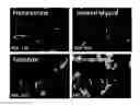 Fig. 22 - Methods of differentiating preadipocytes and uses thereof