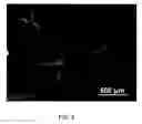 Fig. 08 - Regeneration of a functional pulmonary vascular bed