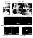 Fig. 14 - Regeneration of a functional pulmonary vascular bed