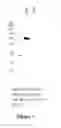 Fig. 02 - MRNA therapy for phenylketonuria