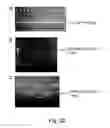 Fig. 35 - Preparation of libraries of protein variants expressed in eukaryotic cells and use for selecting binding molecules