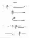 Fig. 17 - NUCLEIC ACID AMPLIFICIATION TECHNIQUES AND METHODS FOR DETECTING BACTERIAL INFECTION