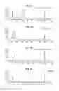 Fig. 12 - Methods of fetal abnormality detection