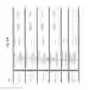 Fig. 15 - Methods of fetal abnormality detection