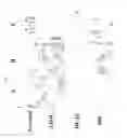 Fig. 02 - Grading of breast cancer