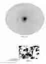 Fig. 10 - Individualized cancer therapy