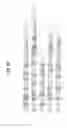 Fig. 03 - Digital sequence analysis of DNA methylation