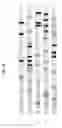 Fig. 23 - Digital sequence analysis of DNA methylation