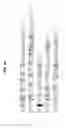 Fig. 24 - Digital sequence analysis of DNA methylation