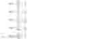 Fig. 60 - Method and device of dynamically configuring linear density and blending ratio of yarn by five-ingredient asynchronous/synchronous drafting