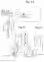 Fig. 02 - Sewing machine presser foot