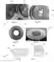 Fig. 03 - High efficiency production of nanofibrillated cellulose