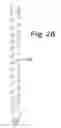 Fig. 13 - Method and apparatus for increasing well productivity