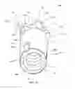 Fig. 10 - Percussion drill bit with at least one wear insert, related systems, and methods