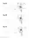 Fig. 09 - PIPE CENTERING AND WASHING APPARATUS