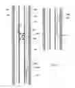 Fig. 13 - Over-coupling screen communication system
