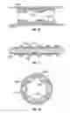 Fig. 09 - Apparatus and method for controlling or limiting rotor orbit in moving cavity motors and pumps
