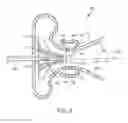 Fig. 07 - Turbocharger compressor noise reduction system and method