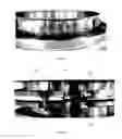 Fig. 10 - Joint seal system and method