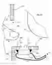 Fig. 16 - Package and light device