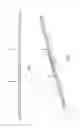 Fig. 02 - Light fixture comprising interchangeable lighting modules