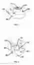Fig. 02 - Tooling friendly adapter for insertion probe access