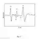 Fig. 07 - ELECTROMAGNETIC WAVE MEASUREMENT DEVICE, MEASUREMENT METHOD, PROGRAM, AND RECORDING MEDIUM