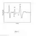 Fig. 07 - ELECTROMAGNETIC WAVE MEASUREMENT DEVICE, MEASUREMENT METHOD, PROGRAM, AND RECORDING MEDIUM