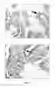 Fig. 09 - Direct immunohistochemistry assay