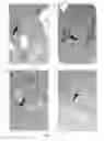 Fig. 17 - Direct immunohistochemistry assay