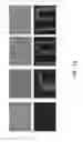 Fig. 16 - Microfluidic System and Method for Real-Time Measurement of Antibody-Antigen Binding and Analyte Detection