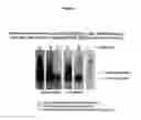 Fig. 04 - Diagnosis of multiple sclerosis