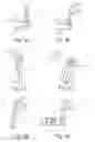 Fig. 04 - Rapid test for the qualitative and/or quantitative analysis of antibodies against human papilloma viruses (HPV) present in body fluid, and device for carrying out the rapid test