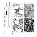 Fig. 03 - Identification of novel diagnostics and therapeutics by modulating RhoH
