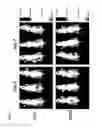 Fig. 08 - Identification of novel diagnostics and therapeutics by modulating RhoH